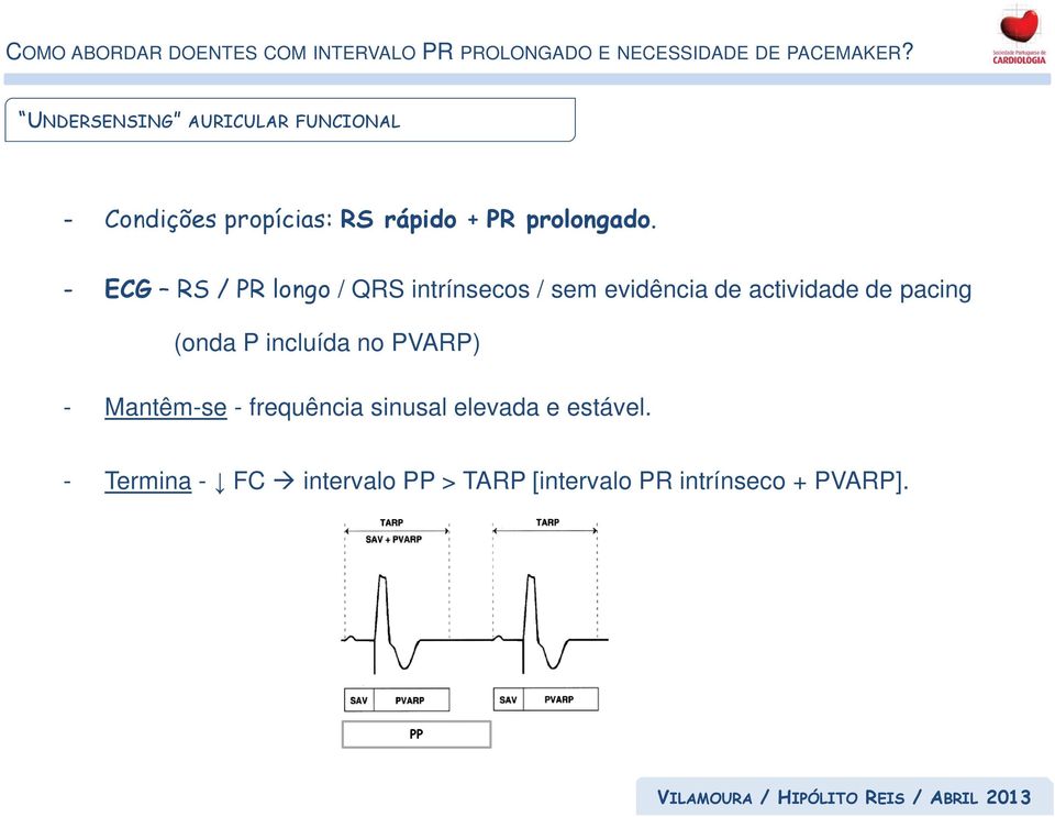 - ECG RS / PR longo / QRS intrínsecos / sem evidência de actividade de pacing