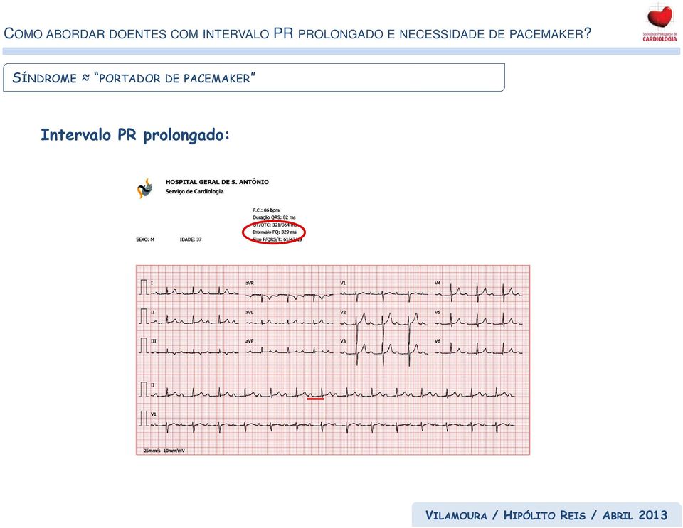 PACEMAKER