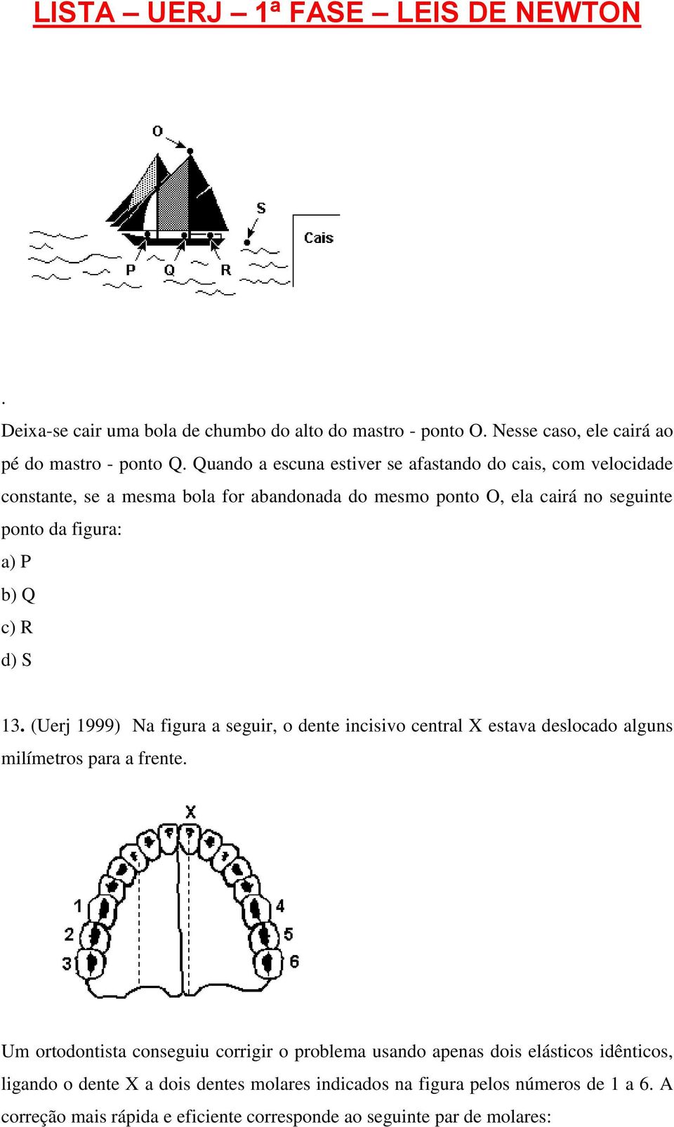 P b) Q c) R d) S 13. (Uerj 1999) Na figura a seguir, o dente incisivo central X estava deslocado alguns milímetros para a frente.