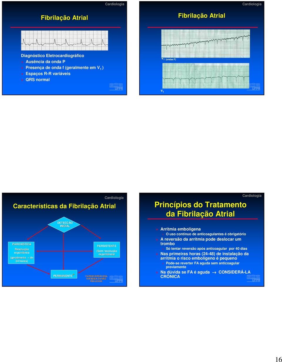 Princípios do Tratamento da Fibrilação Atrial Arritmia embolígena O uso contínuo de anticoagulantes é obrigatório A reversão da arritmia pode deslocar um trombo Só tentar reversão após