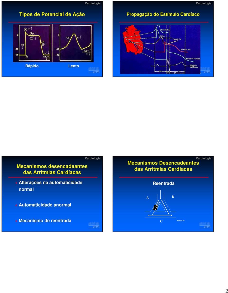 Desencadeantes das Arritmias Cardíacas acas Alterações na automaticidade
