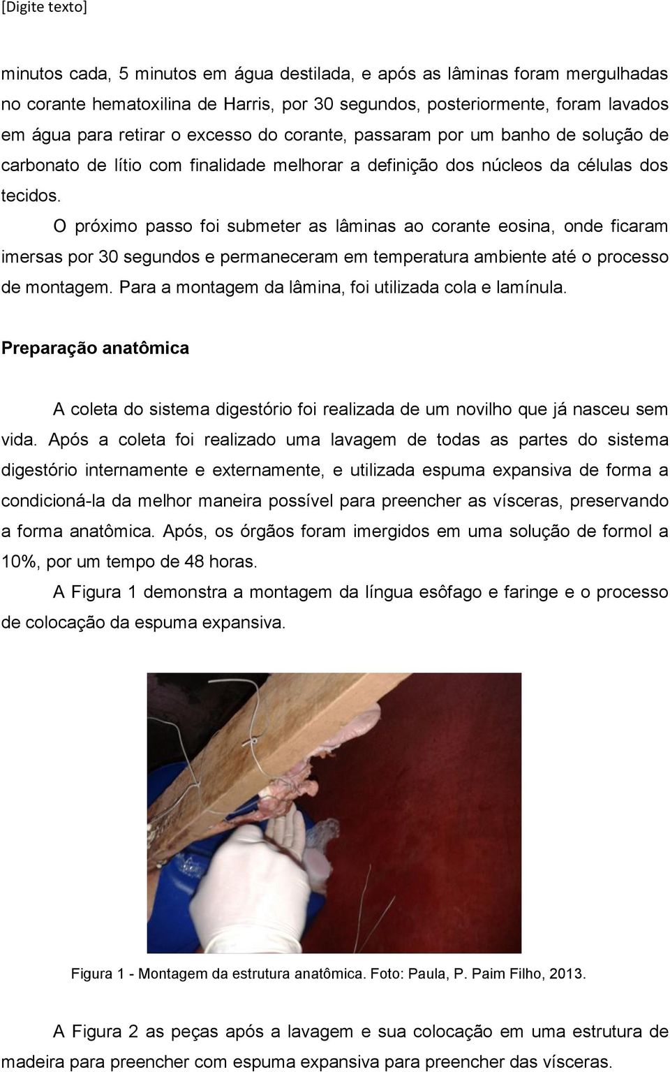 O próximo passo foi submeter as lâminas ao corante eosina, onde ficaram imersas por 30 segundos e permaneceram em temperatura ambiente até o processo de montagem.