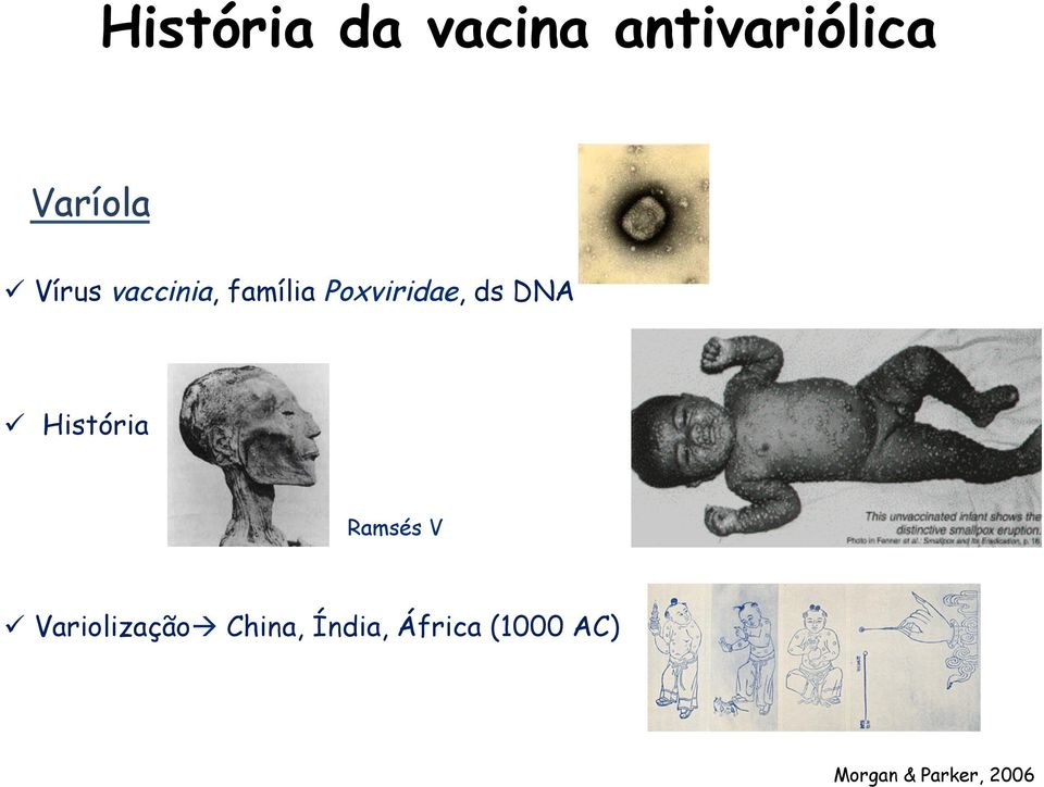 ü História Ramsés V ü Variolizaçãoà China,