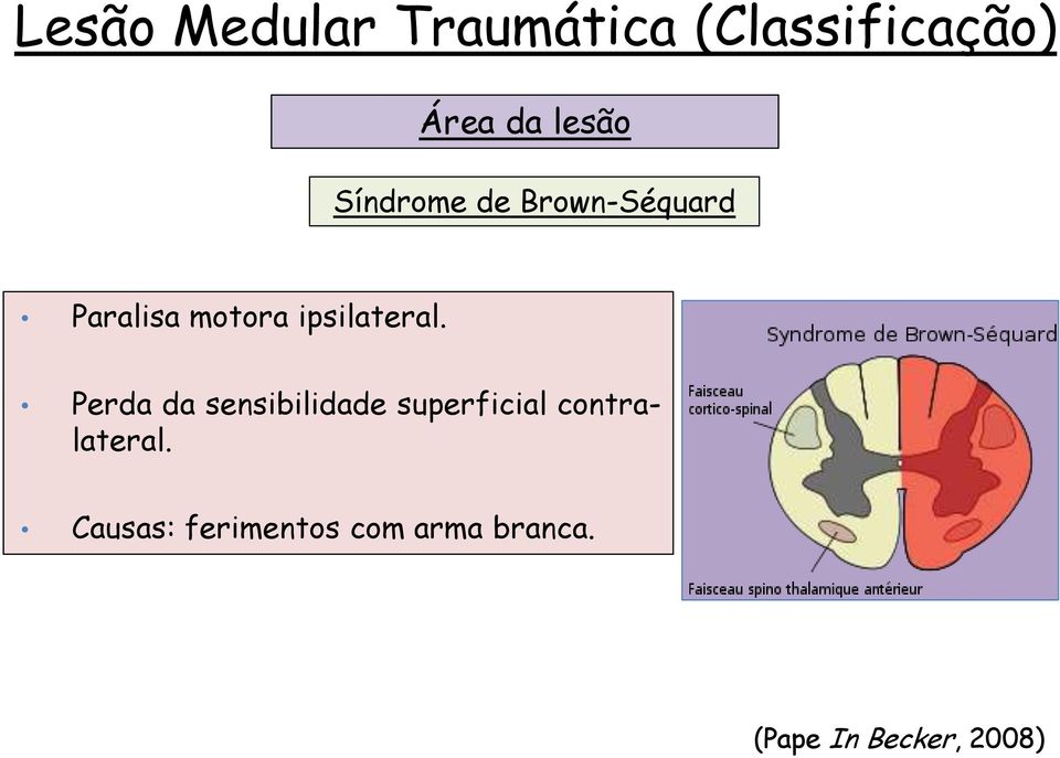 Perda da sensibilidade superficial contralateral.