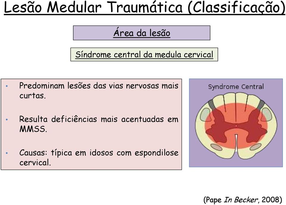 mais curtas. Resulta deficiências mais acentuadas em MMSS.