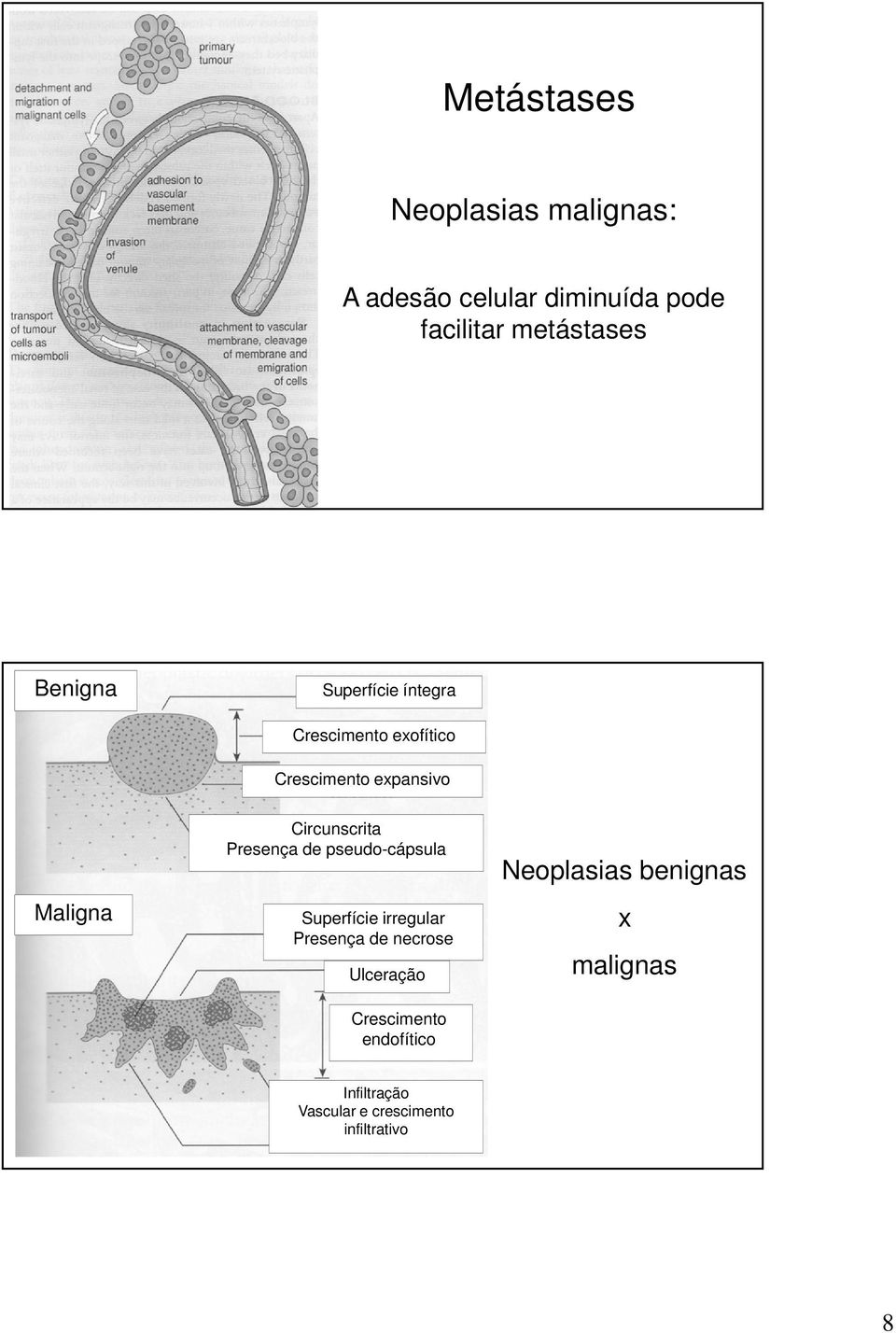 Circunscrita Presença de pseudo-cápsula Superfície irregular Presença de necrose