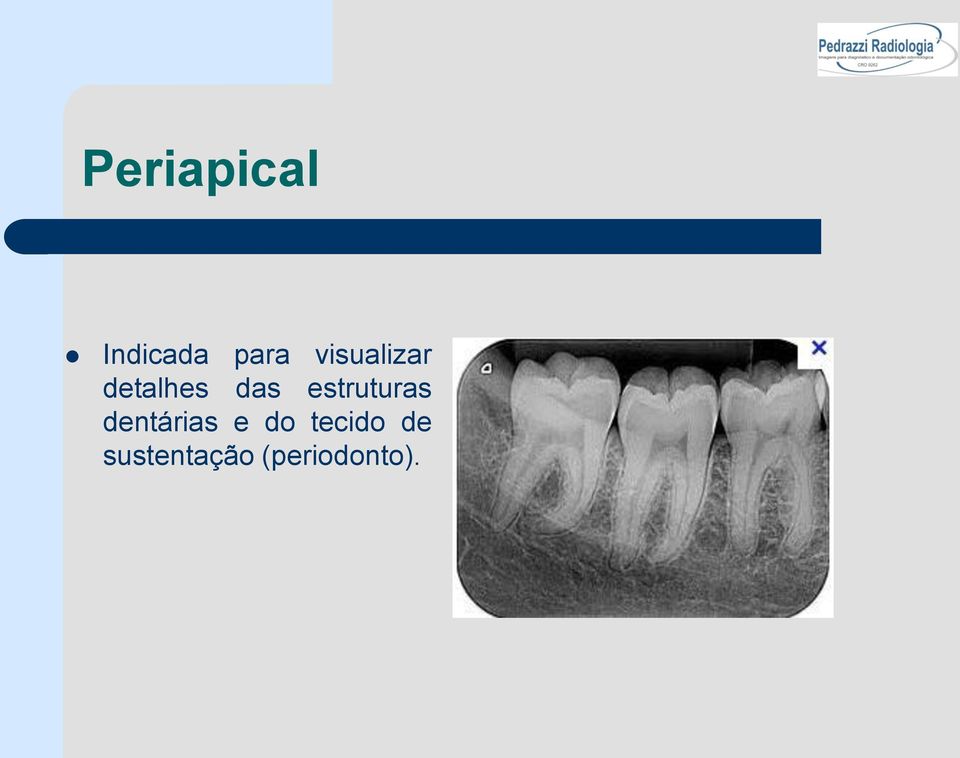 estruturas dentárias e do