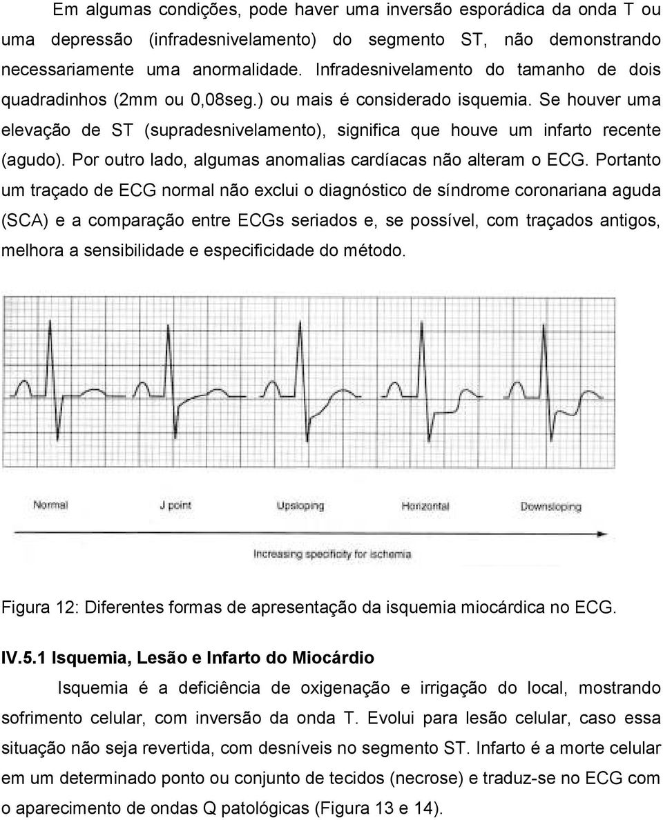 Se houver uma elevação de ST (supradesnivelamento), significa que houve um infarto recente (agudo). Por outro lado, algumas anomalias cardíacas não alteram o ECG.