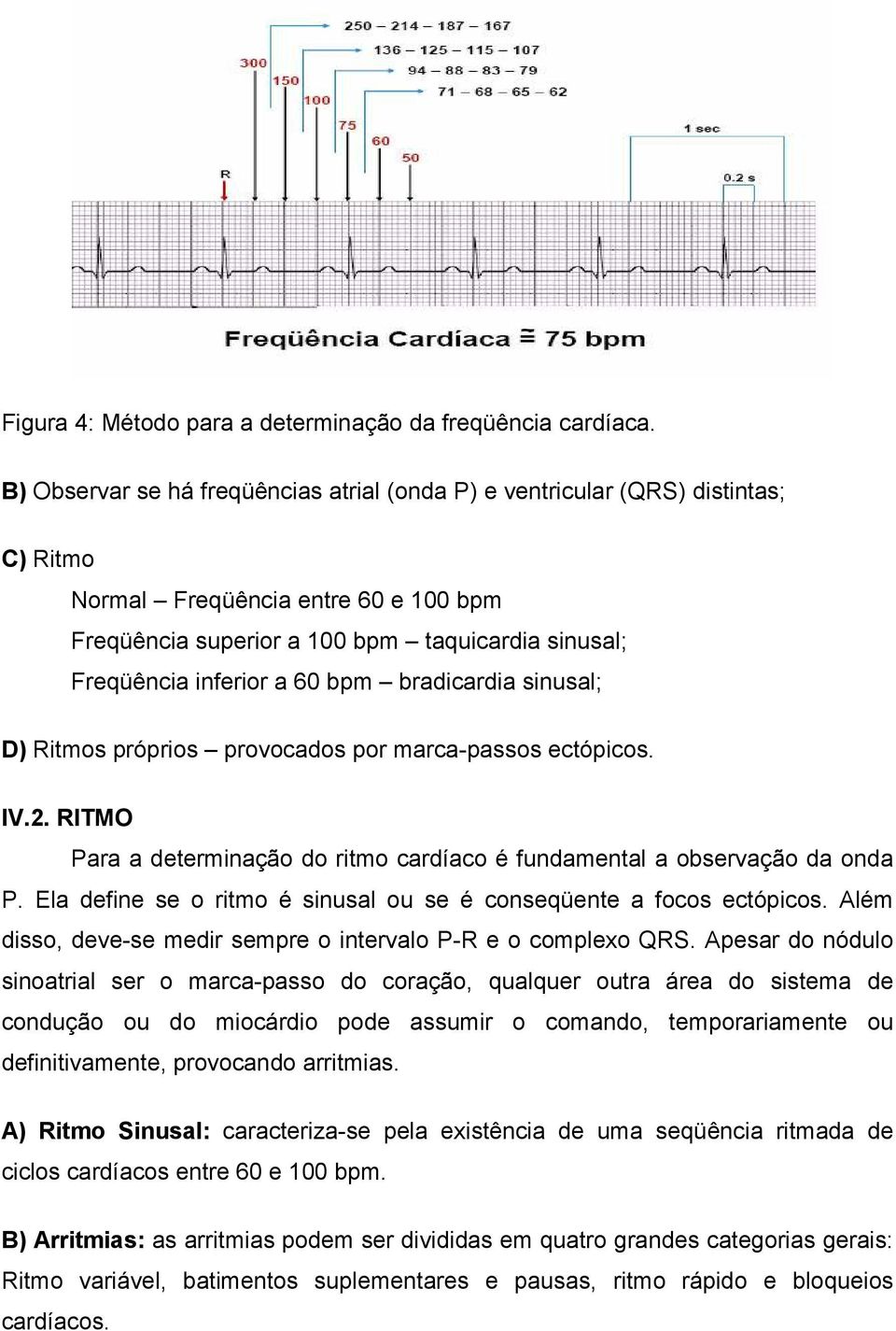 bpm bradicardia sinusal; D) Ritmos próprios provocados por marca-passos ectópicos. IV.2. RITMO Para a determinação do ritmo cardíaco é fundamental a observação da onda P.