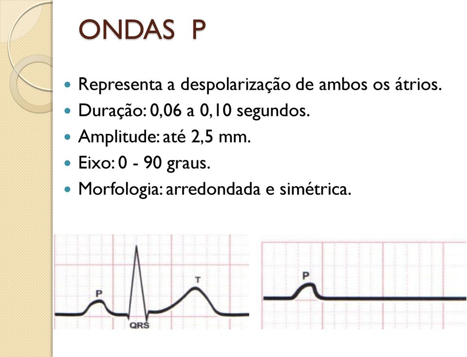 Duração: 0,06 a 0,10 segundos.