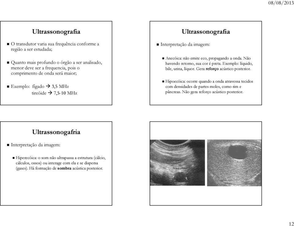 Exemplo: líquido, bile, urina, líquor. Gera reforço acústico posterior. Hipoecóica: ocorre quando a onda atravessa tecidos com densidades de partes moles, como rim e pâncreas.