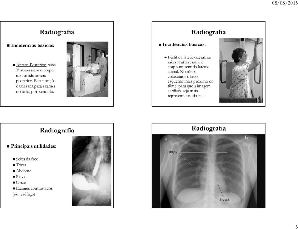 Incidências básicas: Perfil ou látero-lateral: lateral: os raios X atravessam o corpo no sentido látero- lateral.