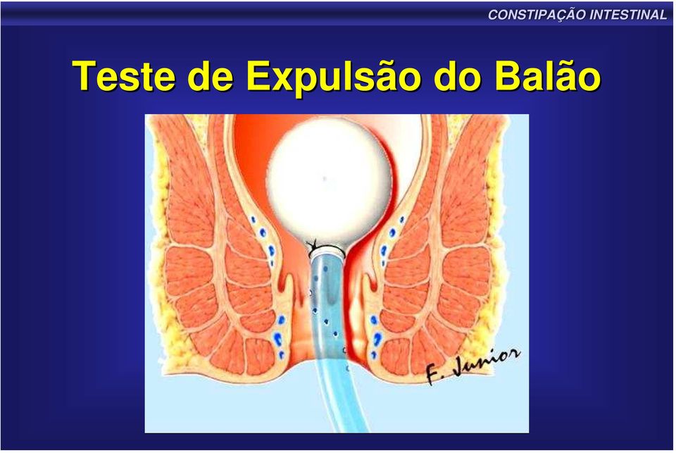 do Balão