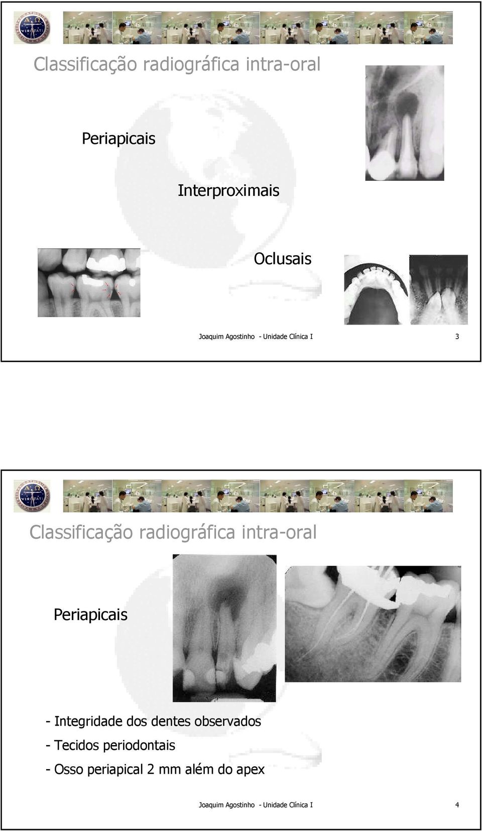 observados - Tecidos periodontais - Osso periapical 2