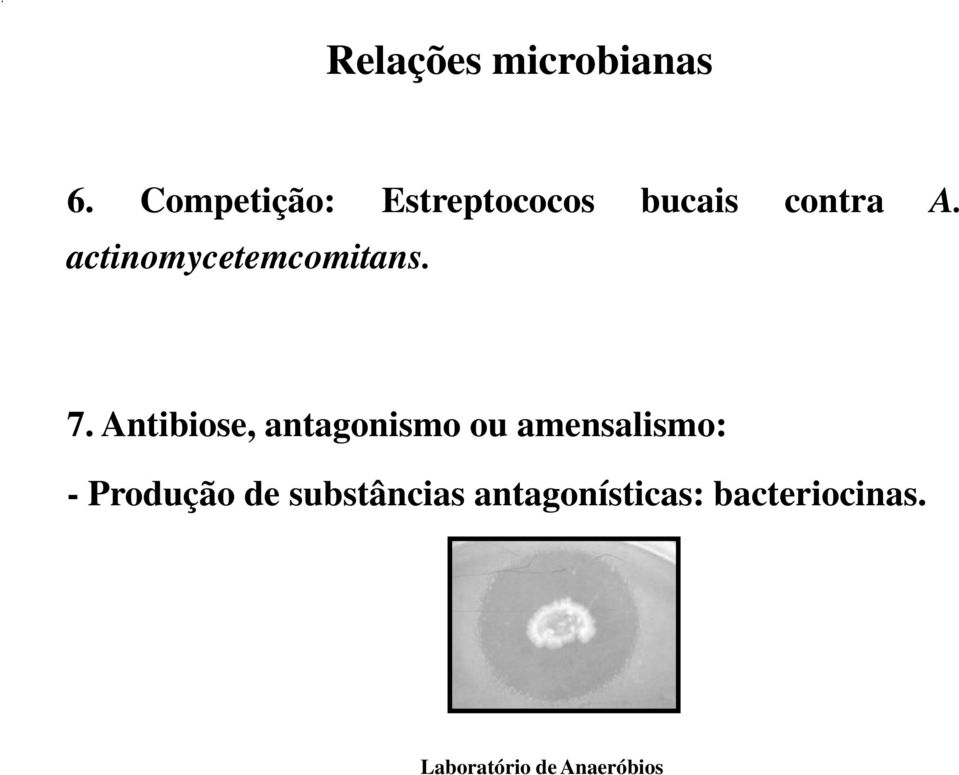 actinomycetemcomitans. 7.