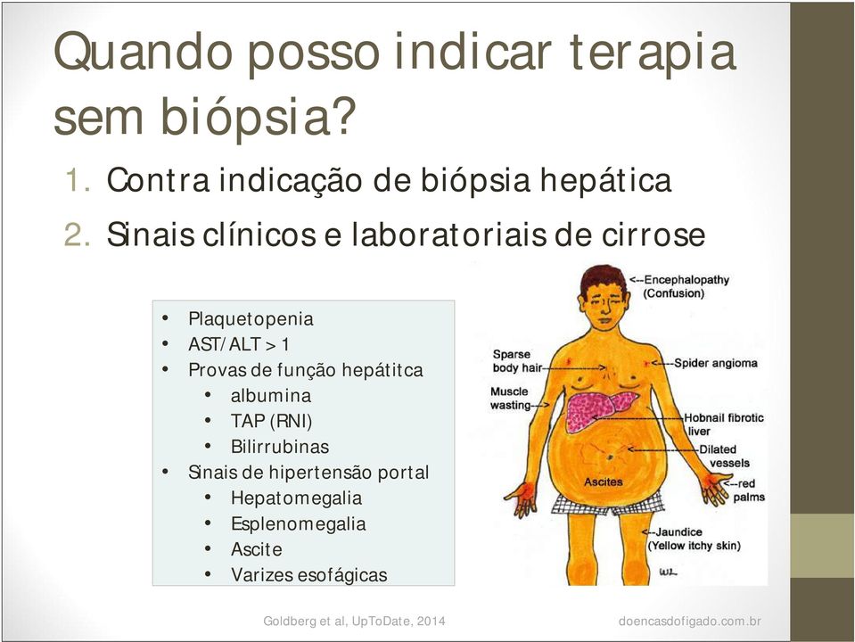 hepátitca albumina TAP (RNI) Bilirrubinas Sinais de hipertensão portal Hepatomegalia