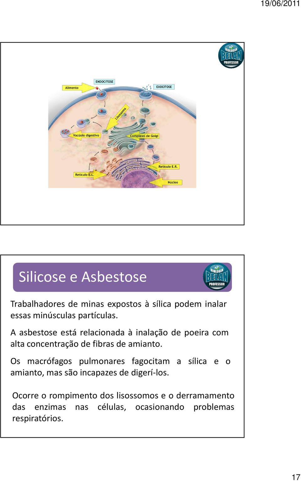 A asbestose está relacionada à inalação de poeira com alta concentração de fibras de amianto.