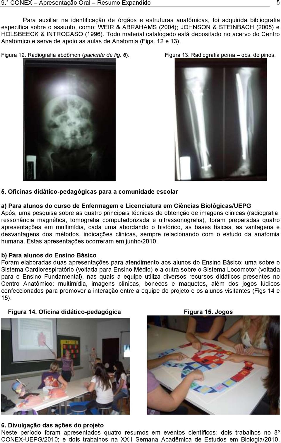 Radiografia abdômen (paciente da fig. 6). Figura 13. Radiografia perna obs. de pinos. 5.