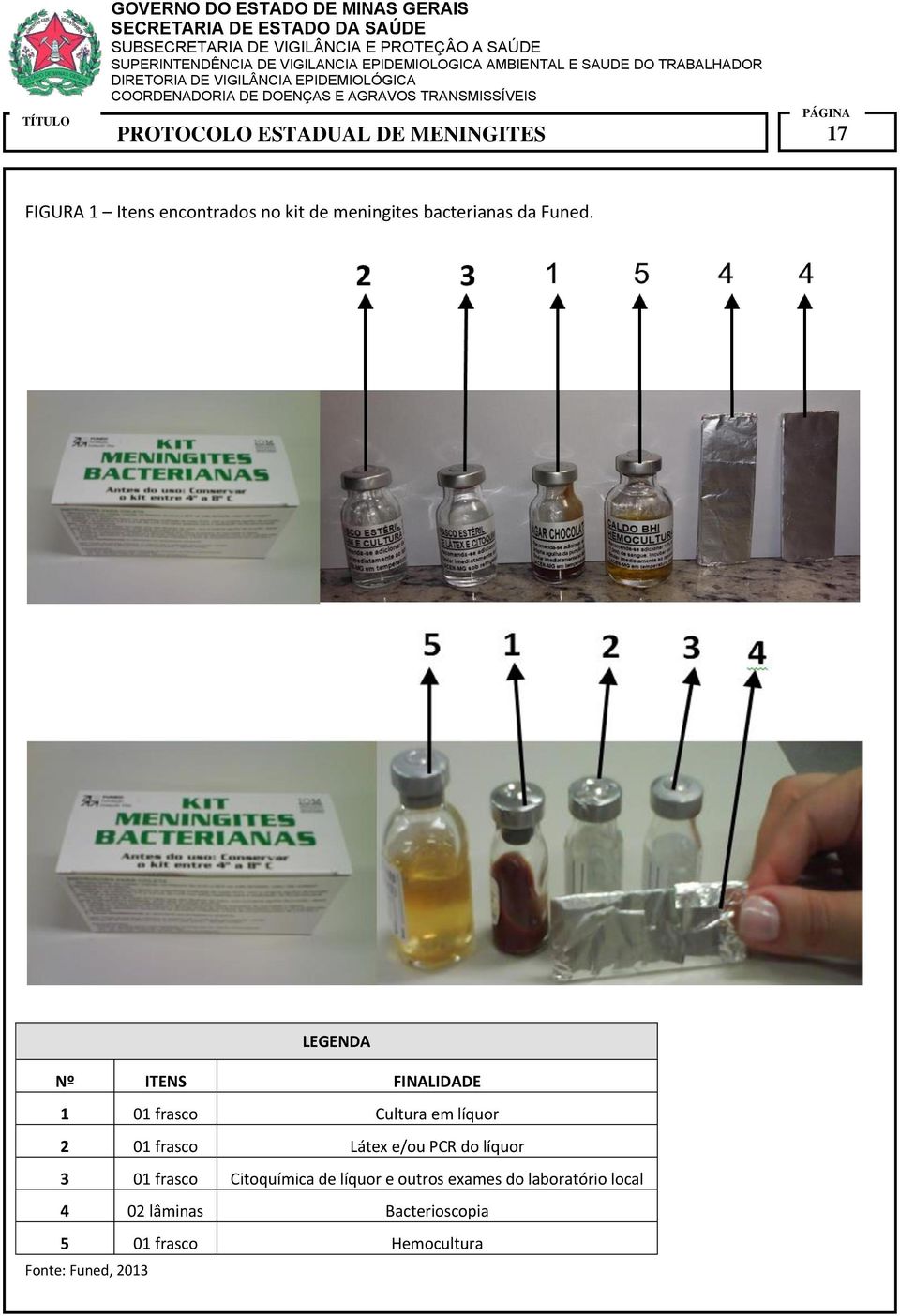 e/ou PCR do líquor 3 01 frasco Citoquímica de líquor e outros exames do