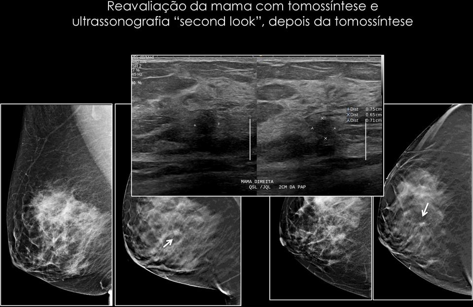 ultrassonografia