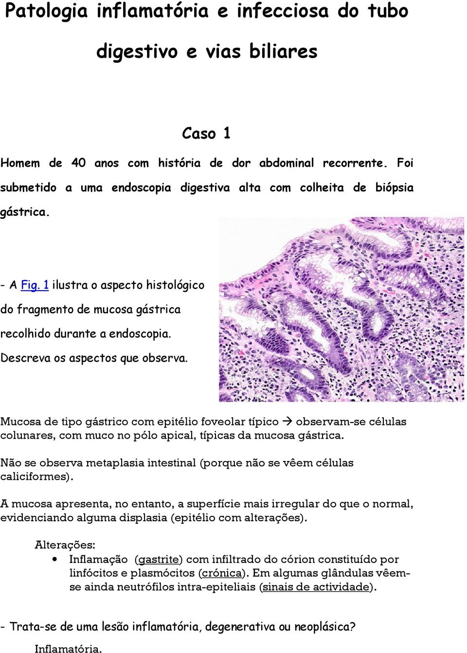 Descreva os aspectos que observa. Mucosa de tipo gástrico com epitélio foveolar típico observam-se células colunares, com muco no pólo apical, típicas da mucosa gástrica.