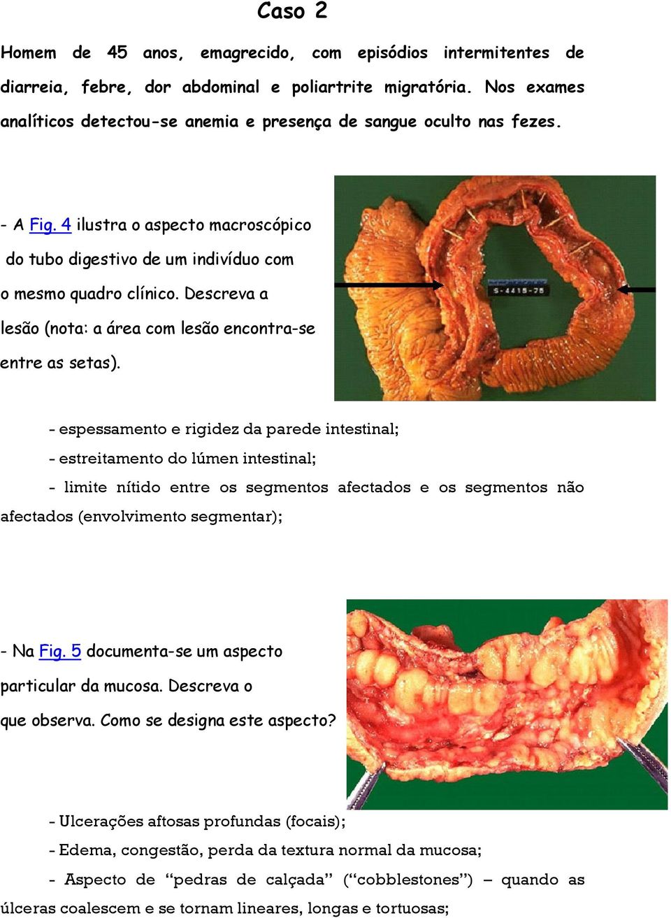 Descreva a lesão (nota: a área com lesão encontra-se entre as setas).