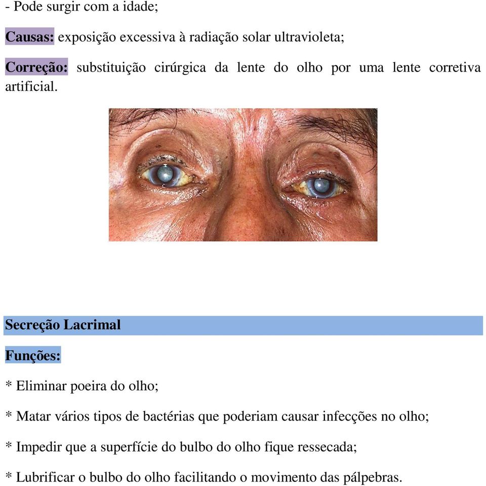 Secreção Lacrimal Funções: * Eliminar poeira do olho; * Matar vários tipos de bactérias que poderiam