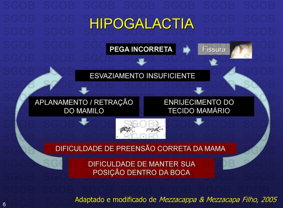 DIFICULDADE DE PREENSÃO CORRETA DA MAMA DIFICULDADE DE MANTER SUA