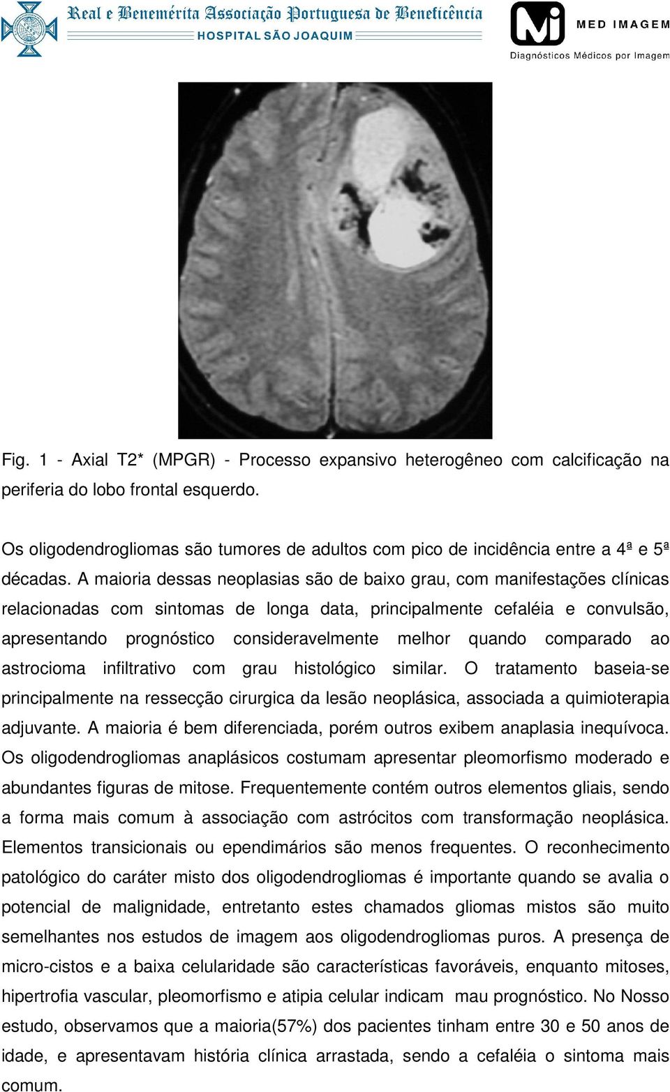 A maioria dessas neoplasias são de baixo grau, com manifestações clínicas relacionadas com sintomas de longa data, principalmente cefaléia e convulsão, apresentando prognóstico consideravelmente