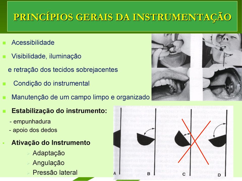 de um campo limpo e organizado Estabilização do instrumento: - empunhadura -