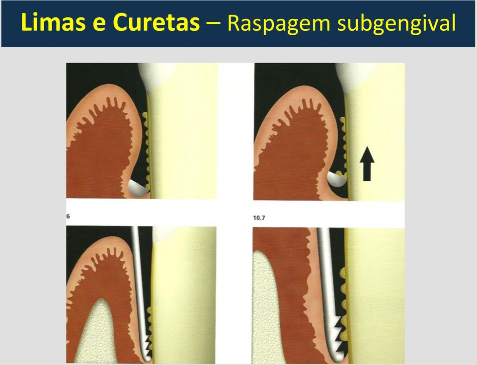 Raspagem