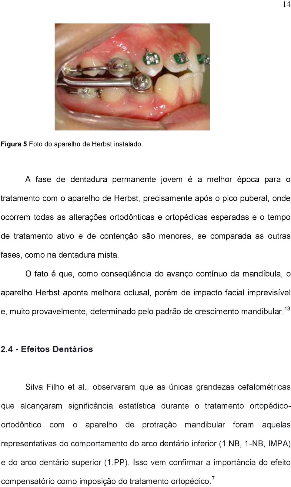 esperadas e o tempo de tratamento ativo e de contenção são menores, se comparada as outras fases, como na dentadura mista.