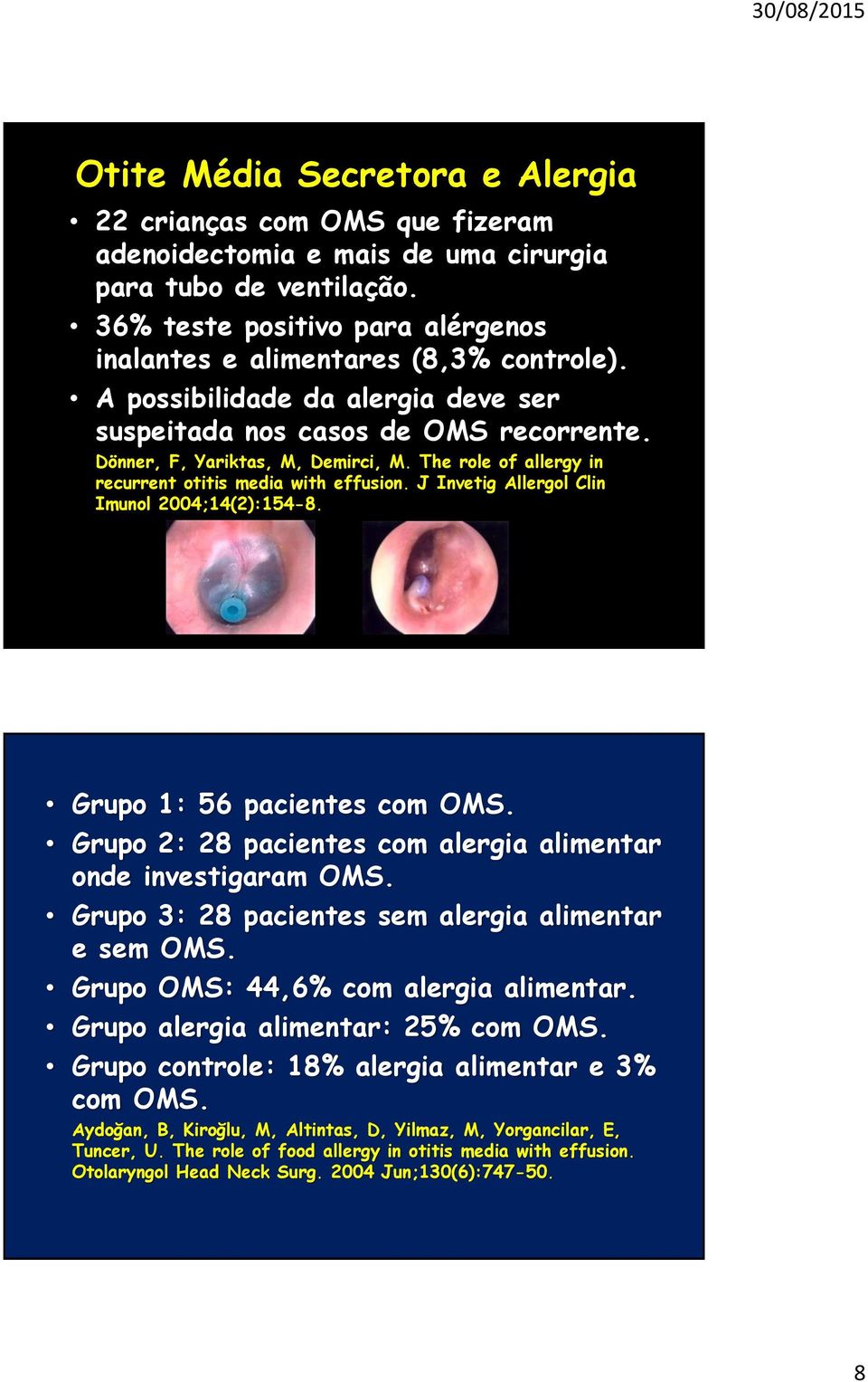 The role of allergy in recurrent otitis media with effusion. J Invetig Allergol Clin Imunol 2004;14(2):154-8. Grupo 1: 56 pacientes com OMS.