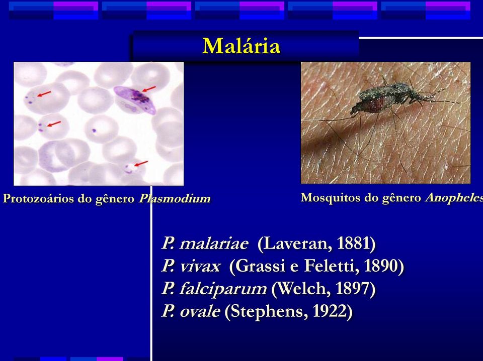 malariae (Laveran, 1881) P.