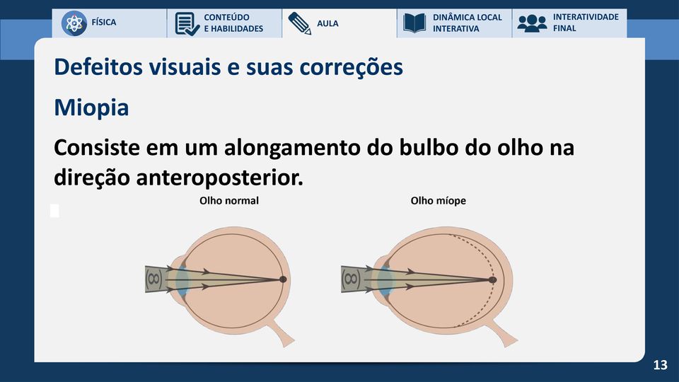 um alongamento do bulbo do