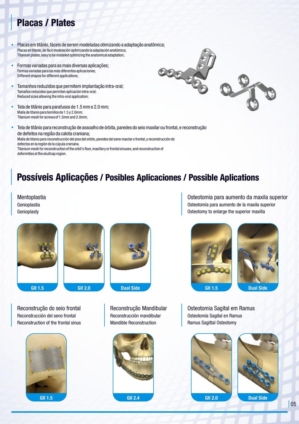 Tamanhos reduzidos que permitem implantação intra-oral; Tamaños reducidos que permiten aplicación intra-oral; Reduced sizes allowing the intra-oral application; Tela de titânio para parafusos de 1.