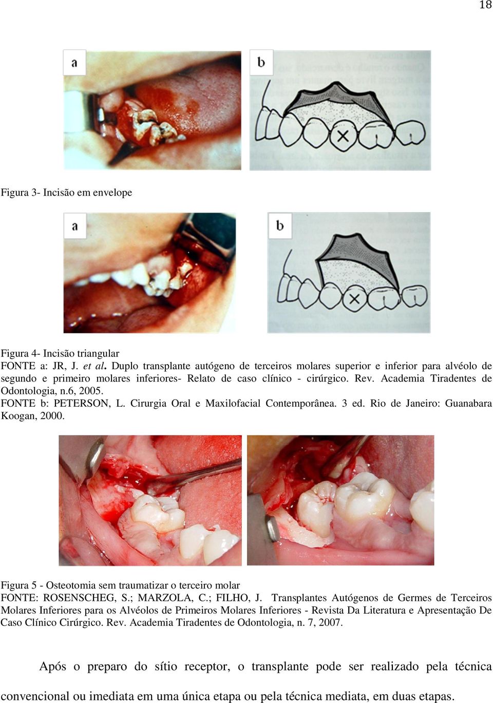Academia Tiradentes de Odontologia, n.6, 2005. FONTE b: PETERSON, L. Cirurgia Oral e Maxilofacial Contemporânea. 3 ed. Rio de Janeiro: Guanabara Koogan, 2000.