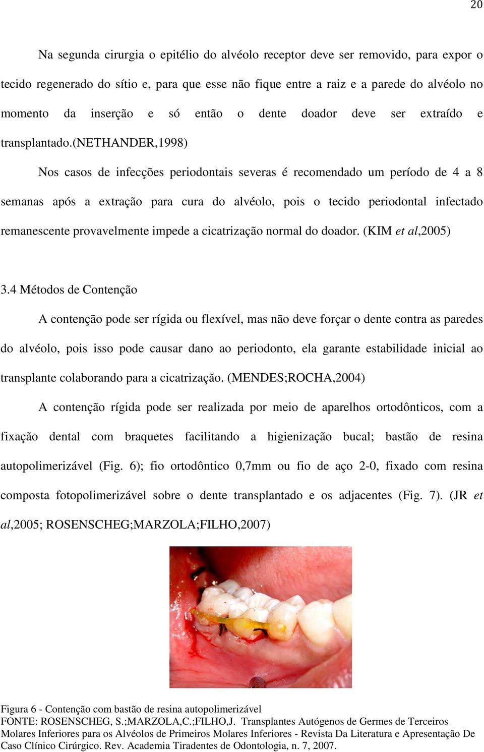 (nethander,1998) Nos casos de infecções periodontais severas é recomendado um período de 4 a 8 semanas após a extração para cura do alvéolo, pois o tecido periodontal infectado remanescente