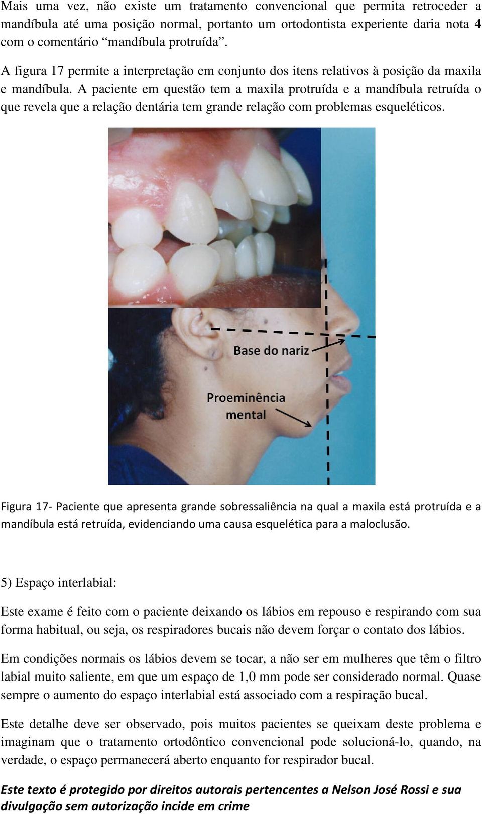 A paciente em questão tem a maxila protruída e a mandíbula retruída o que revela que a relação dentária tem grande relação com problemas esqueléticos.