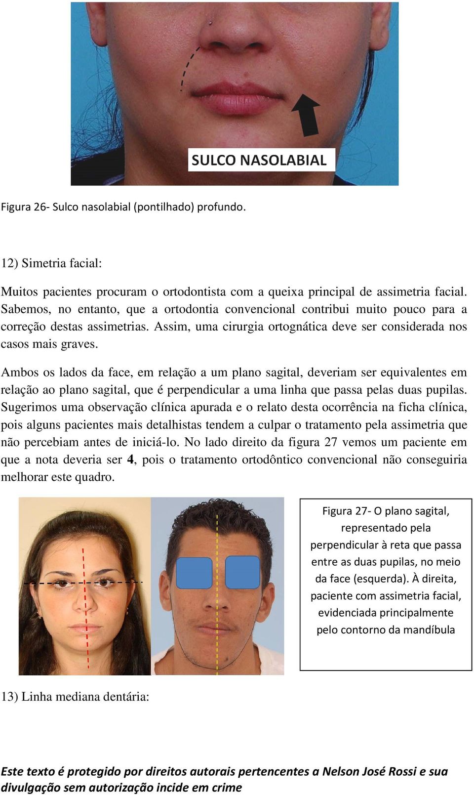 Ambos os lados da face, em relação a um plano sagital, deveriam ser equivalentes em relação ao plano sagital, que é perpendicular a uma linha que passa pelas duas pupilas.