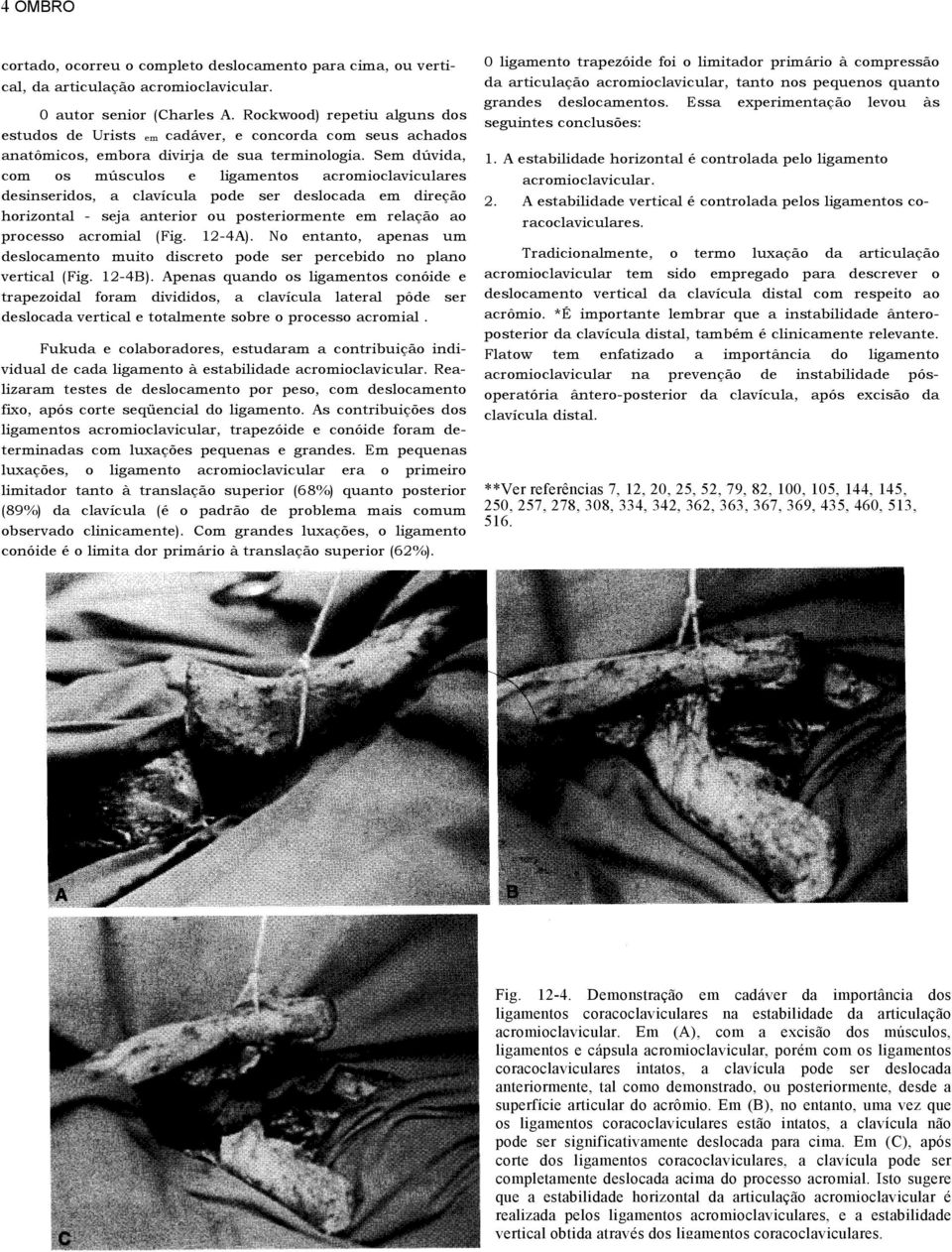 Sem dúvida, com os músculos e ligamentos acromioclaviculares desinseridos, a clavícula pode ser deslocada em direção horizontal - seja anterior ou posteriormente em relação ao processo acromial (Fig.