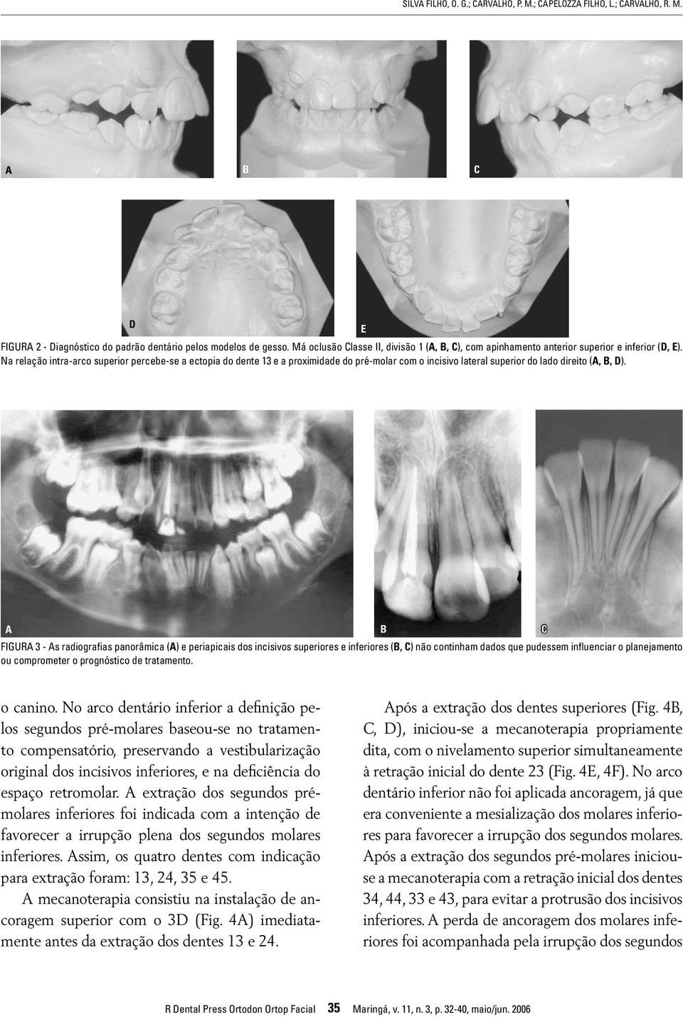 Na relação intra-arco superior percebe-se a ectopia do dente 13 e a proximidade do pré-molar com o incisivo lateral superior do lado direito (,, D).