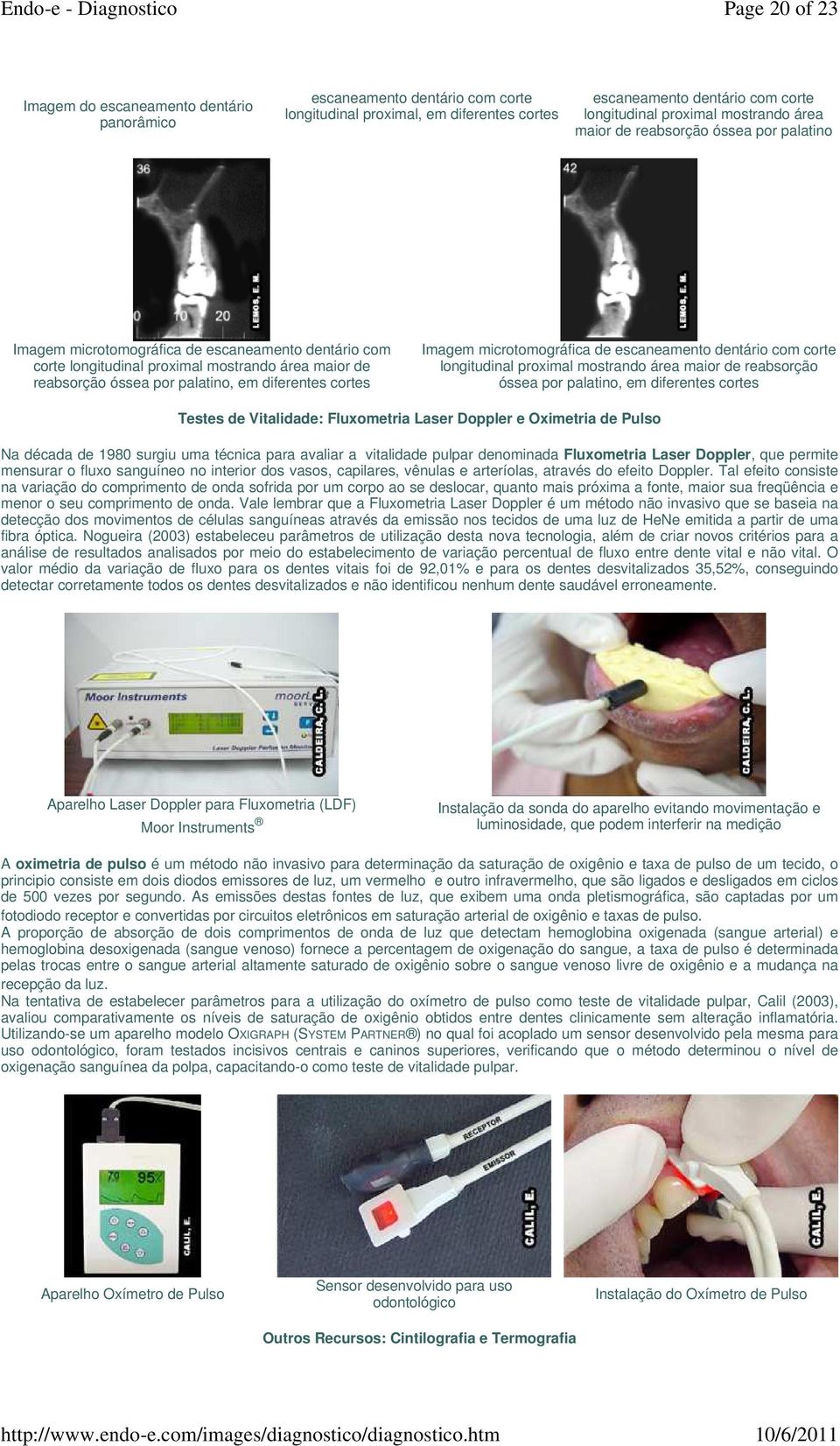 cortes Imagem microtomográfica de escaneamento dentário com corte longitudinal proximal mostrando área maior de reabsorção óssea por palatino, em diferentes cortes Testes de Vitalidade: Fluxometria