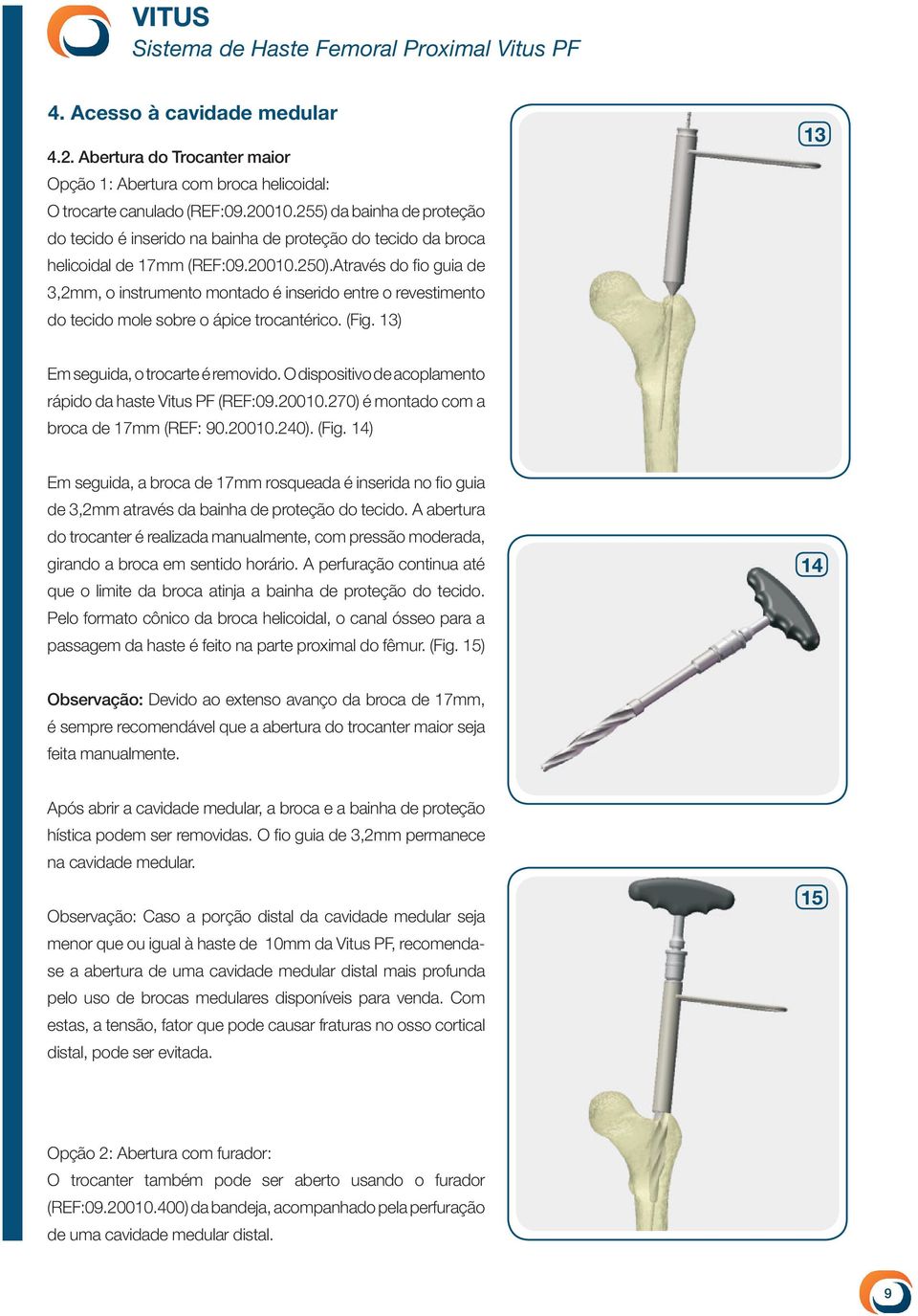 Através do fio guia de 3,2mm, o instrumento montado é inserido entre o revestimento do tecido mole sobre o ápice trocantérico. (Fig. 13) 13 Em seguida, o trocarte é removido.