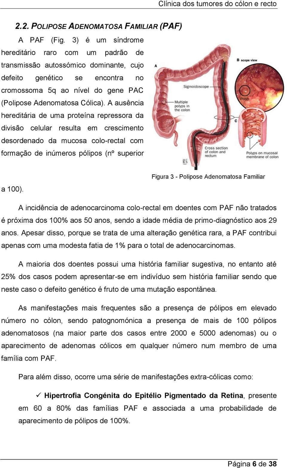 A ausência hereditária de uma proteína repressora da divisão celular resulta em crescimento desordenado da mucosa colo-rectal com formação de inúmeros pólipos (nº superior Figura 3 - Polipose