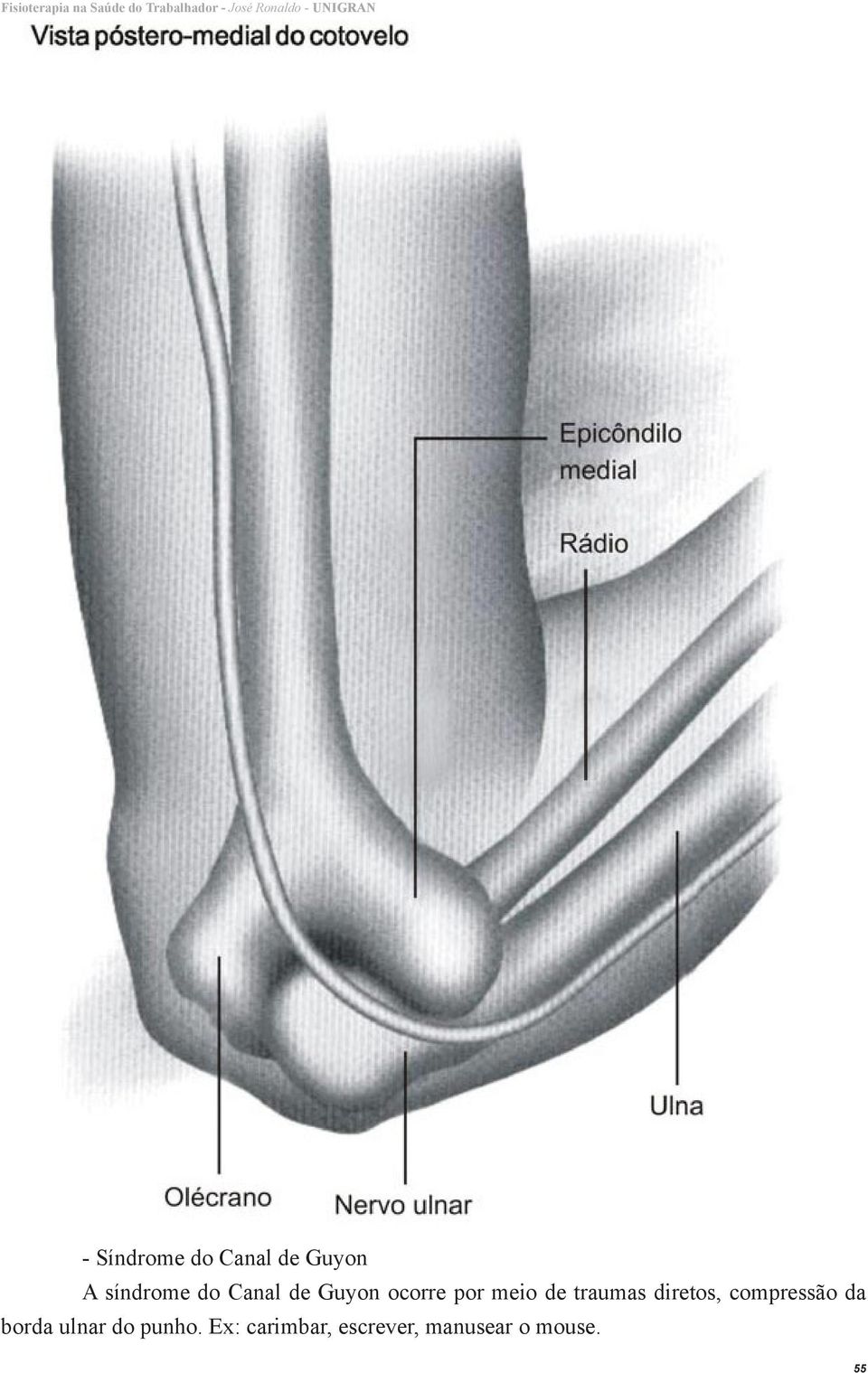 diretos, compressão da borda ulnar do punho.