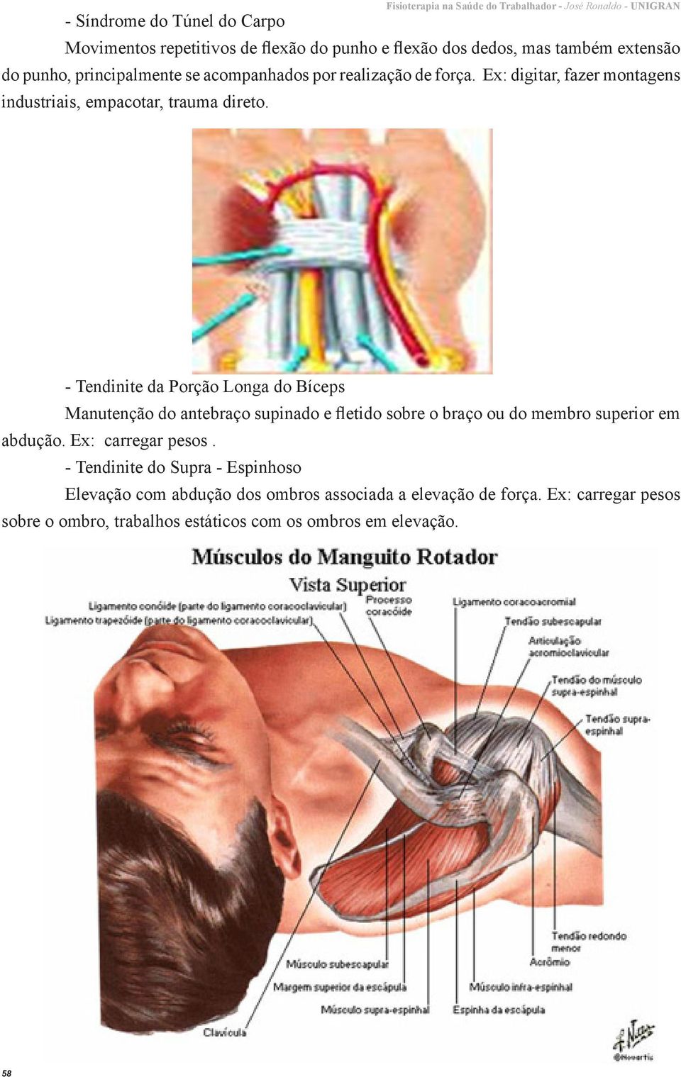 - Tendinite da Porção Longa do Bíceps Manutenção do antebraço supinado e fletido sobre o braço ou do membro superior em abdução. Ex: carregar pesos.