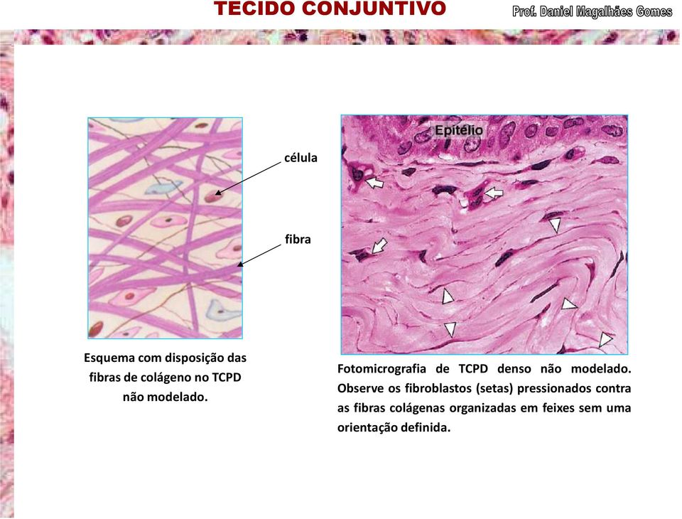 Observe os fibroblastos (setas) pressionados contra as fibras