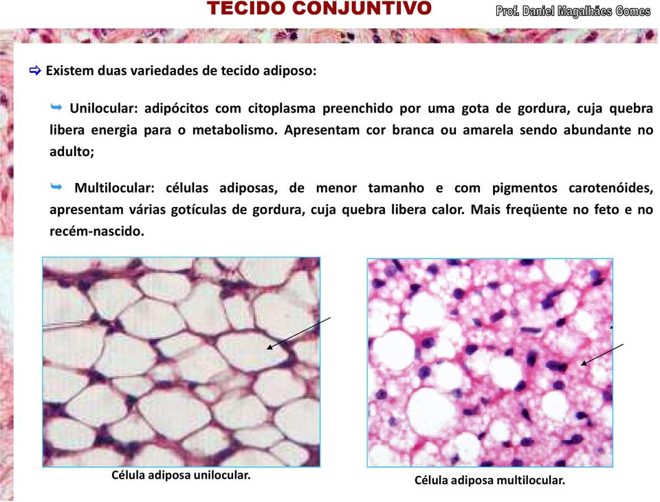 Apresentam cor branca ou amarela sendo abundante no adulto; Multilocular: células adiposas, de menor tamanho e com