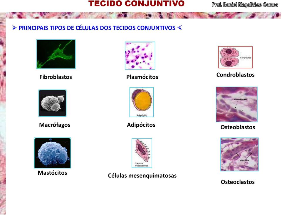 Condroblastos Macrófagos Adipócitos